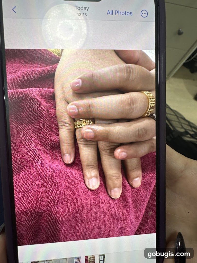 Hands with Rings
