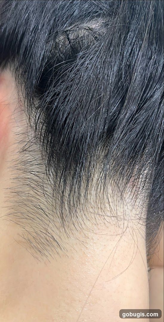 Close-up of Hairline
