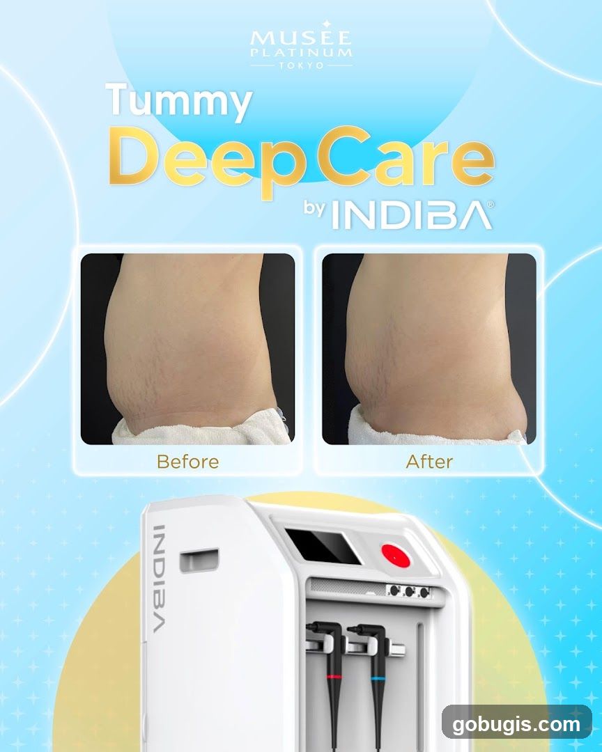 Tummy DeepCare by INDIBA