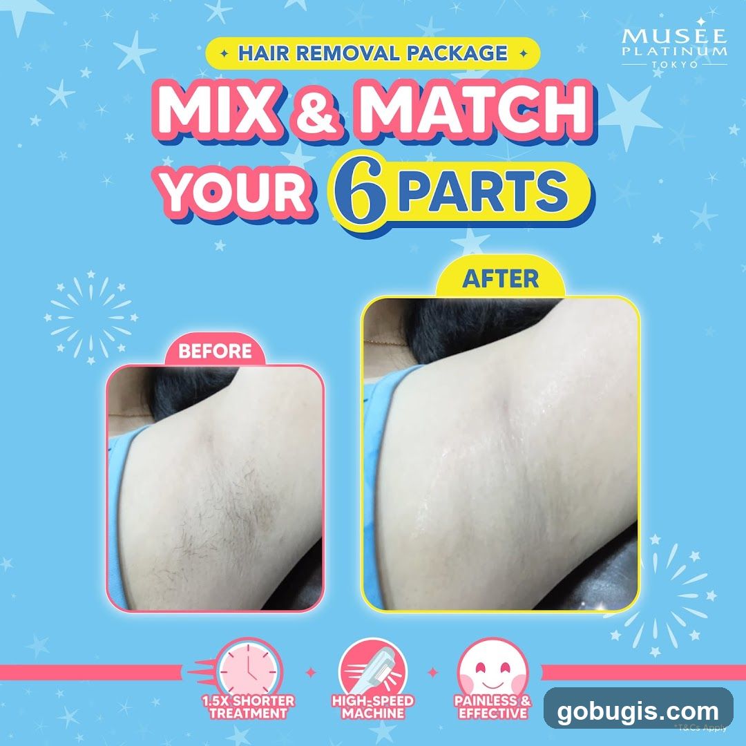 Musee Platinum Tokyo Hair Removal Package
