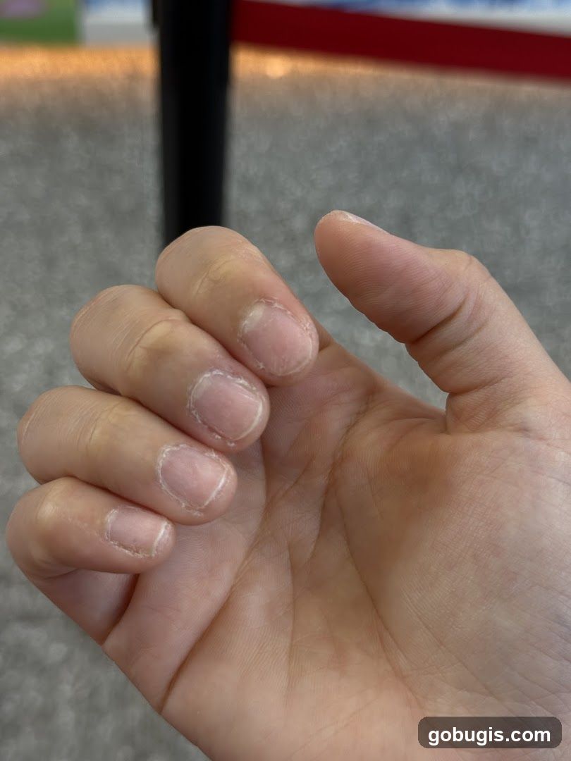 Hand with unpolished nails