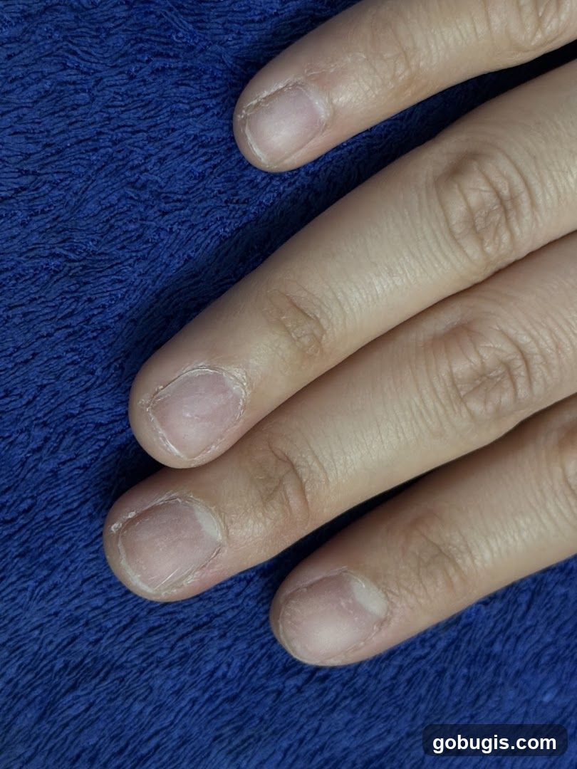 Fingernails on Blue Towel