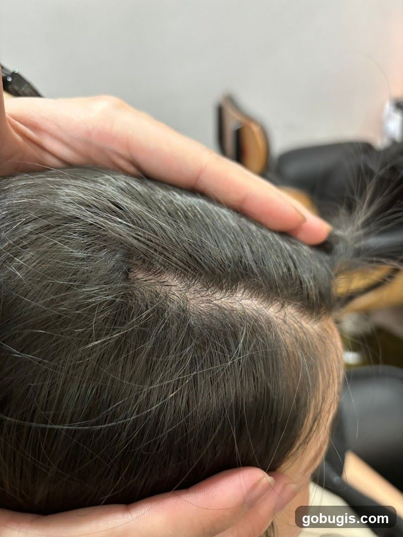 Close-up of scalp with dark hair