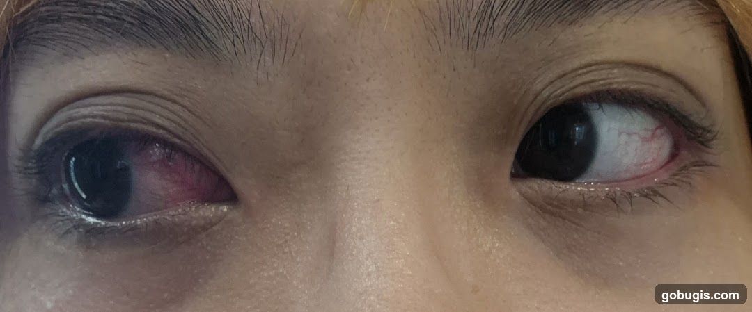 Close-up of irritated eyes
