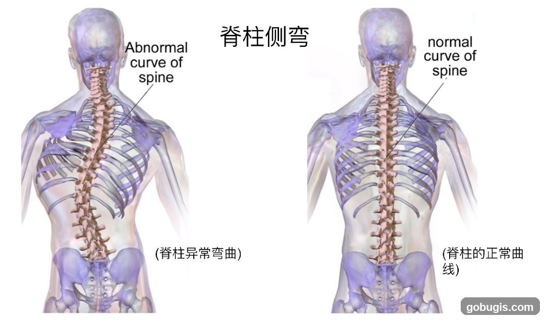 Spinal Curvature Comparison