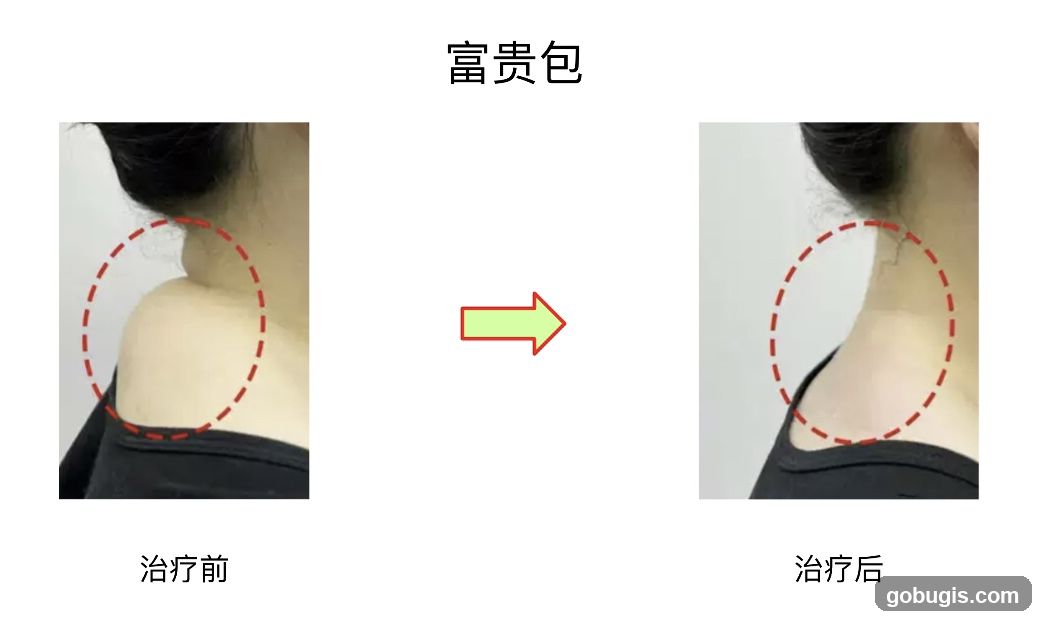 Before and After Treatment