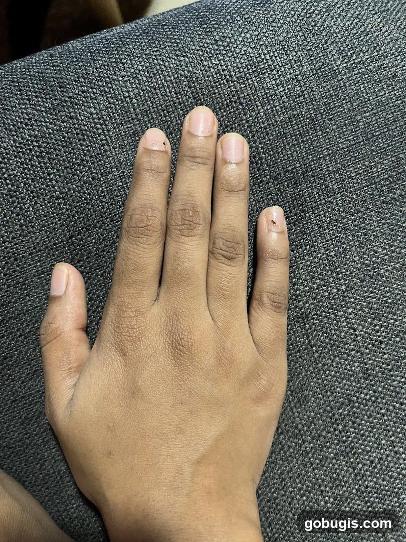 Hand with unpolished nails