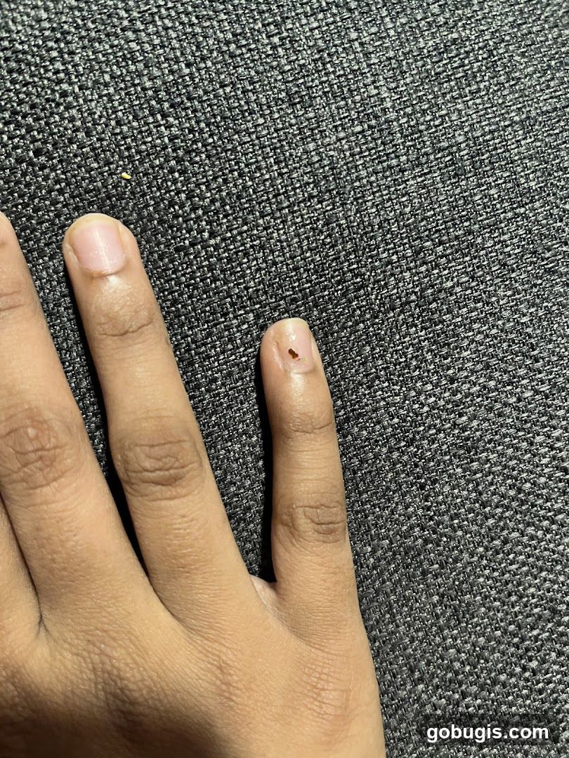 Close-up of a hand with a small brown speck on a fingernail