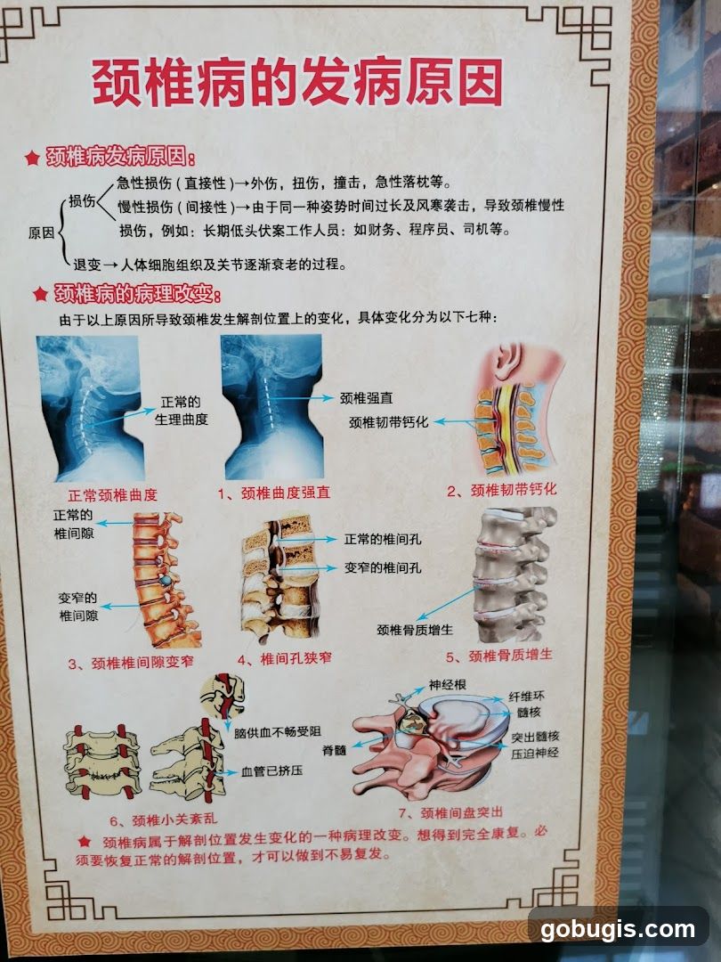 Causes of Cervical Spondylosis