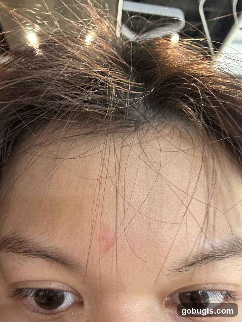 Close-up of a person's forehead and eyes