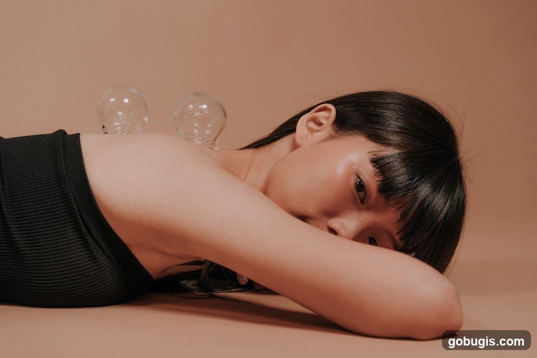Cupping Therapy