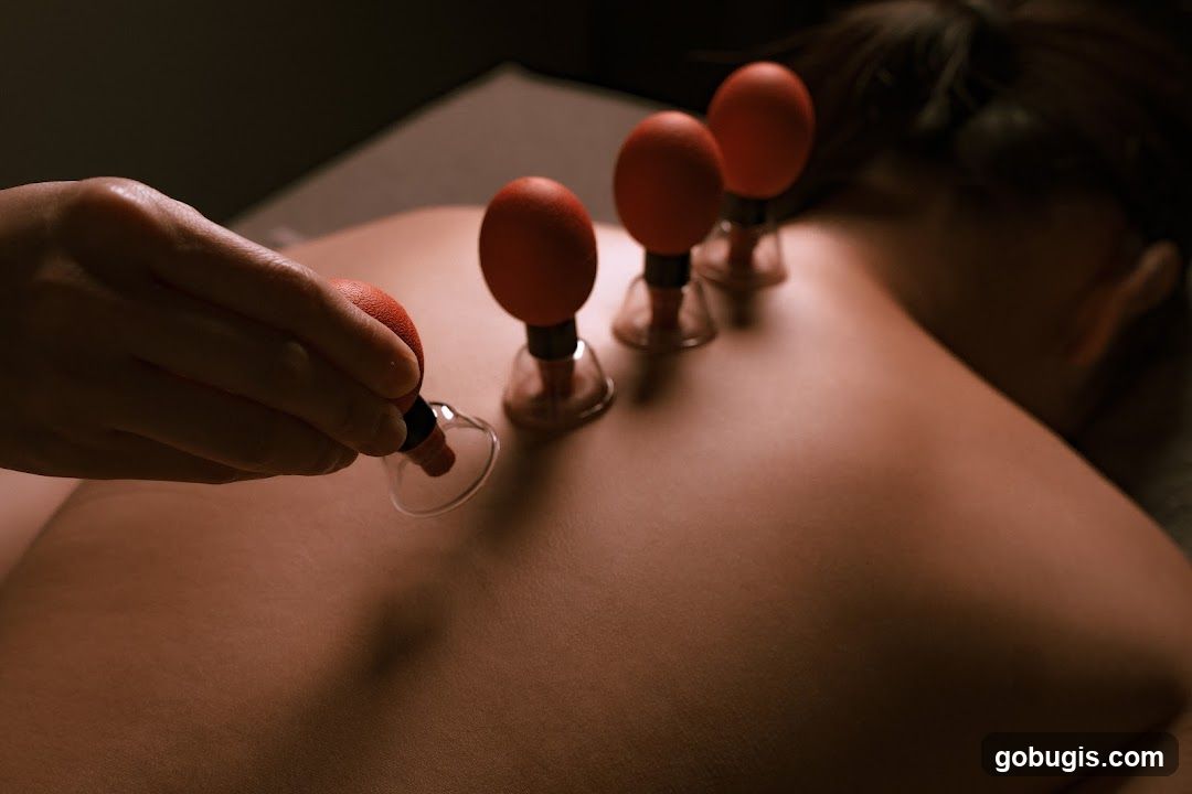 Cupping Therapy
